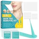 Análisis y comparativa de los mejores tratamientos para quitar lunares en Madrid antes de tu boda Análisis y comparativa de los mejores tratamientos para quitar lunares en Madrid antes de tu boda